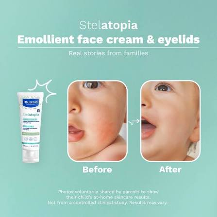 MUSTELA Stelatopia Cream 40 ML