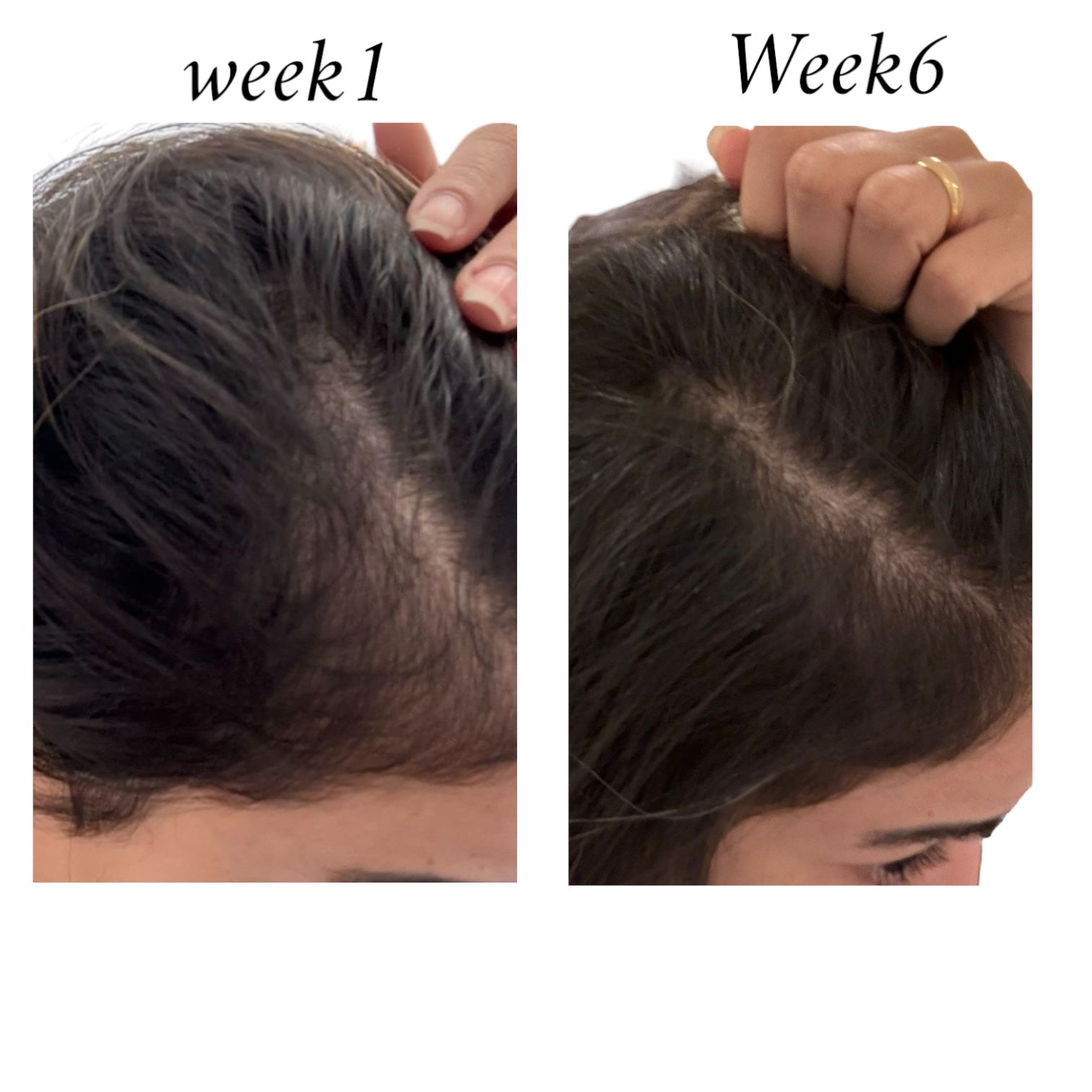 Raw African Follicle Booster Redensyl Daily Spray