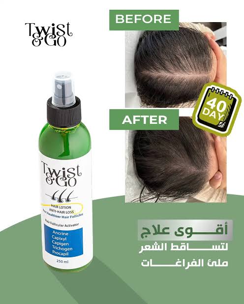 TWIST & GO ANTI HAIR LOSS LOTION 250ML  لوشن علاج تساقط الشعر