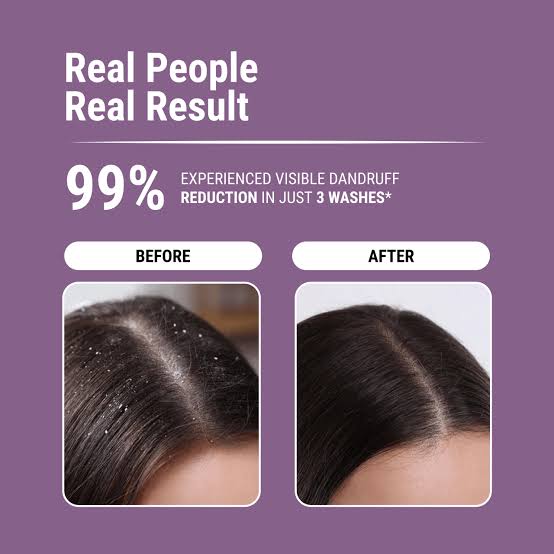 EVER YOUTH ANTI DANDRUFF SHAMPOO